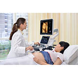 Стаціонарний УЗД апарат експертного класу Mindray DC-70, фото 9