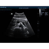 Портативний УЗД DP50 Mindray, фото 5