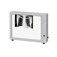 Негатоскоп Н-1 для перегляду знімків медичний