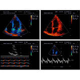 Портативний УЗД експертного класу M7 Mindray, фото 5