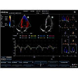 Портативний УЗД експертного класу M7 Mindray, фото 6