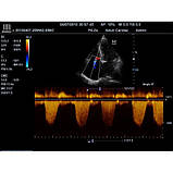 Портативний УЗД експертного класу M7 Mindray, фото 7