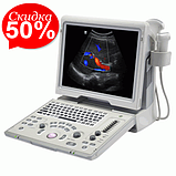 ЗІП апарат Z5-ультразвукова діагностична система з кольоровим доплером, фото 2