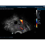 ЗІП апарат Z5-ультразвукова діагностична система з кольоровим доплером, фото 4