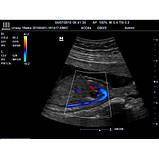 Стаціонарне ПЗІ експерного класу DC-T6 Mindray, фото 5