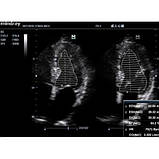 Стаціонарне ПЗІ експерного класу DC-T6 Mindray, фото 6