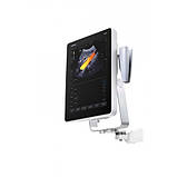 Мобільний УЗД апарат TE7 із сенсорним екраном, фото 4