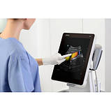 Мобільний УЗД апарат TE7 із сенсорним екраном, фото 6