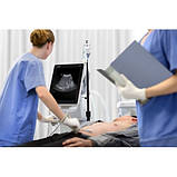 Мобільний УЗД апарат TE7 із сенсорним екраном, фото 7