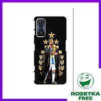 Чехол для Xiaomi POCO F4 GT (Messi King) / Чехлы на Поко Ф4 GT Месси