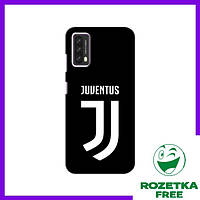 Чохол Blackview A90 (ФК Ювентус) / Чехлы Juventus Блеквью А90