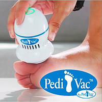 Пемза для ніг  ⁇  Прилад для видалення мозолів  ⁇  Електрична пемза для ніг Pedi Vac