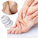 Пемза для ніг  ⁇  Прилад для видалення мозолів  ⁇  Електрична пемза для ніг Pedi Vac, фото 7