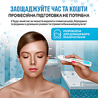 Електрокоагулятор плазмовий прилад для видалення папілом бородавок апарат Plasma Pen (плазмова ручка) XPREEN 051, фото 8