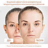 EMS МІКРОТОК MEDICA+ ЛІФТИНГ-МАСАЖЕР для обличчя SKIN LIFTING 6.0 PINK  (ЯПОНІЯ), фото 6