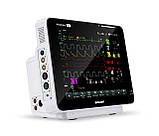 Монітор пацієнта S12 з модулем вимірювання СО2, фото 2