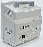 Монітор пацієнта ВМ800А Медапаратура, фото 2