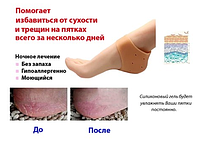 Силиконовый фиксатор для пяток, цена улет