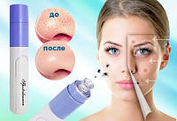 Face Cleaner для чистки лица, хороший выбор