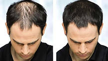 Кератиновий загусник для волосся Toppik 27,5г + аплікатор + гребінець, фото 2