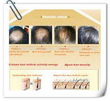 Оригінал!New! Лікувальна есенція, активатор і відновлення росту волосся "Snazii" (30 мл)., фото 5