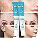 Точковий гель від прищів MOOYAM Salicylic Acid, 20 g, фото 6