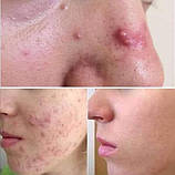 Себорегулююча та порозвужуюча маска з чорною вулканічною глиною, 75 мл, фото 8