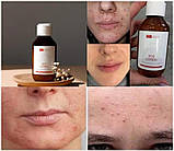 Себорегулююча та порозвужуюча маска з чорною вулканічною глиною, 75 мл, фото 9