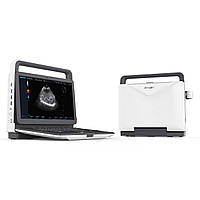 Портативна система ультразвукова діагностична Zoncare M30