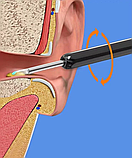 Прилад для чищення вух NE3, фото 3