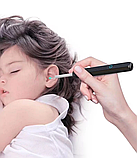 Прилад для чищення вух NE3, фото 7