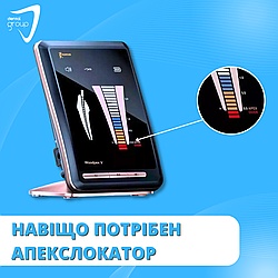 Навіщо потрібен апекслокатор?