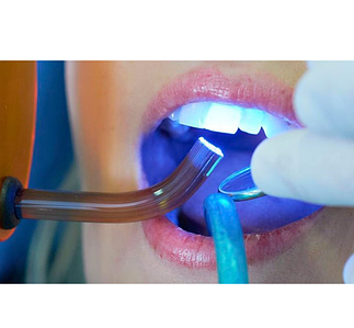 Світловідповідні композити (фотополімери)