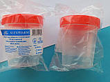 Ємність (контейнер) для збору сечі стерильний 120 мл з кришкою "Alexpharm", фото 2