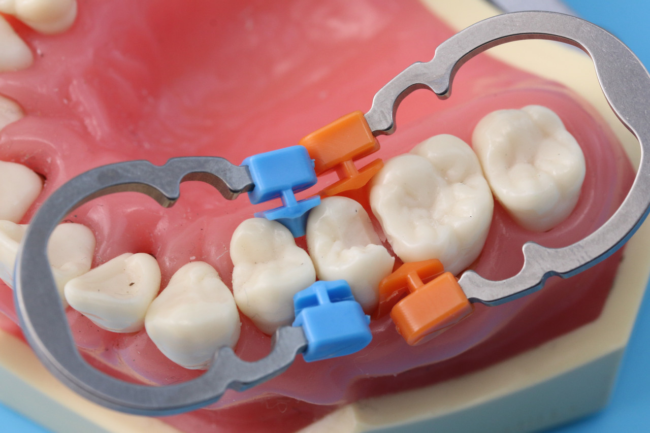 Матричне кільце (1шт) DENTPARK 2шт