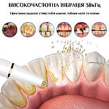 Скалер стоматологічний для зубів ультразвуковий для видалення зубного каменю Dental Tools білий (GS-113137), фото 6
