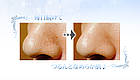Belulu Skin Clear Pore електрична щітка для очищення шкіри обличчя й пор, водонепроникна (KRD1048), фото 5