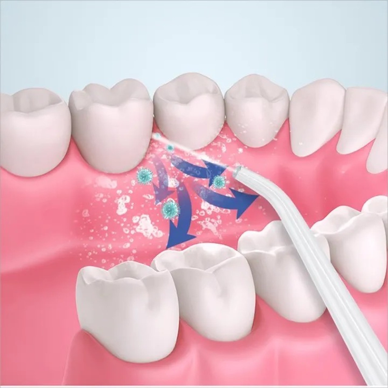 Ирригатор для тщательной чистки между зубами - фото 4 - id-p2015029523