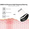 Ультразвуковий скрабер для чищення обличчя Ultrasonic Beauty Home Black, фото 3