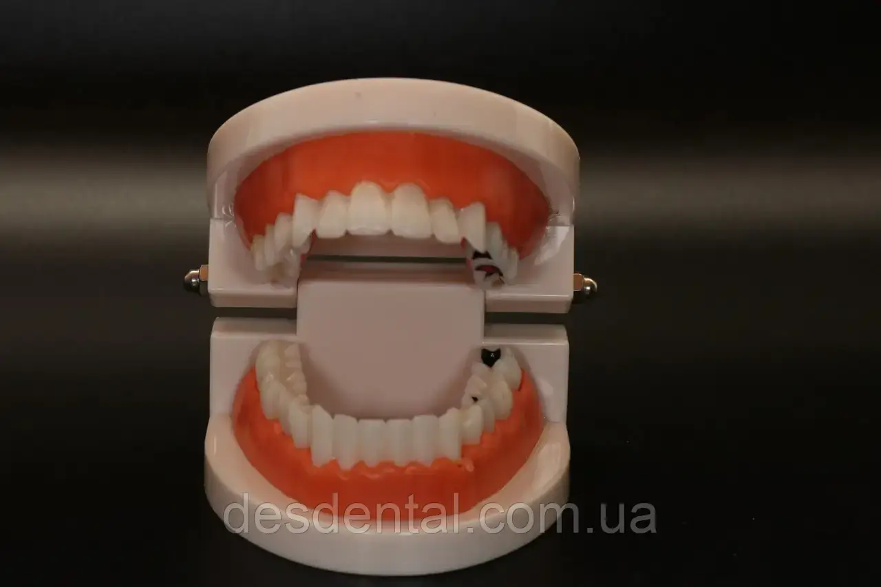 Модель   стоматологічна з патологіями  демонстраційна