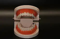 Модель   стоматологічна з патологіями  демонстраційна