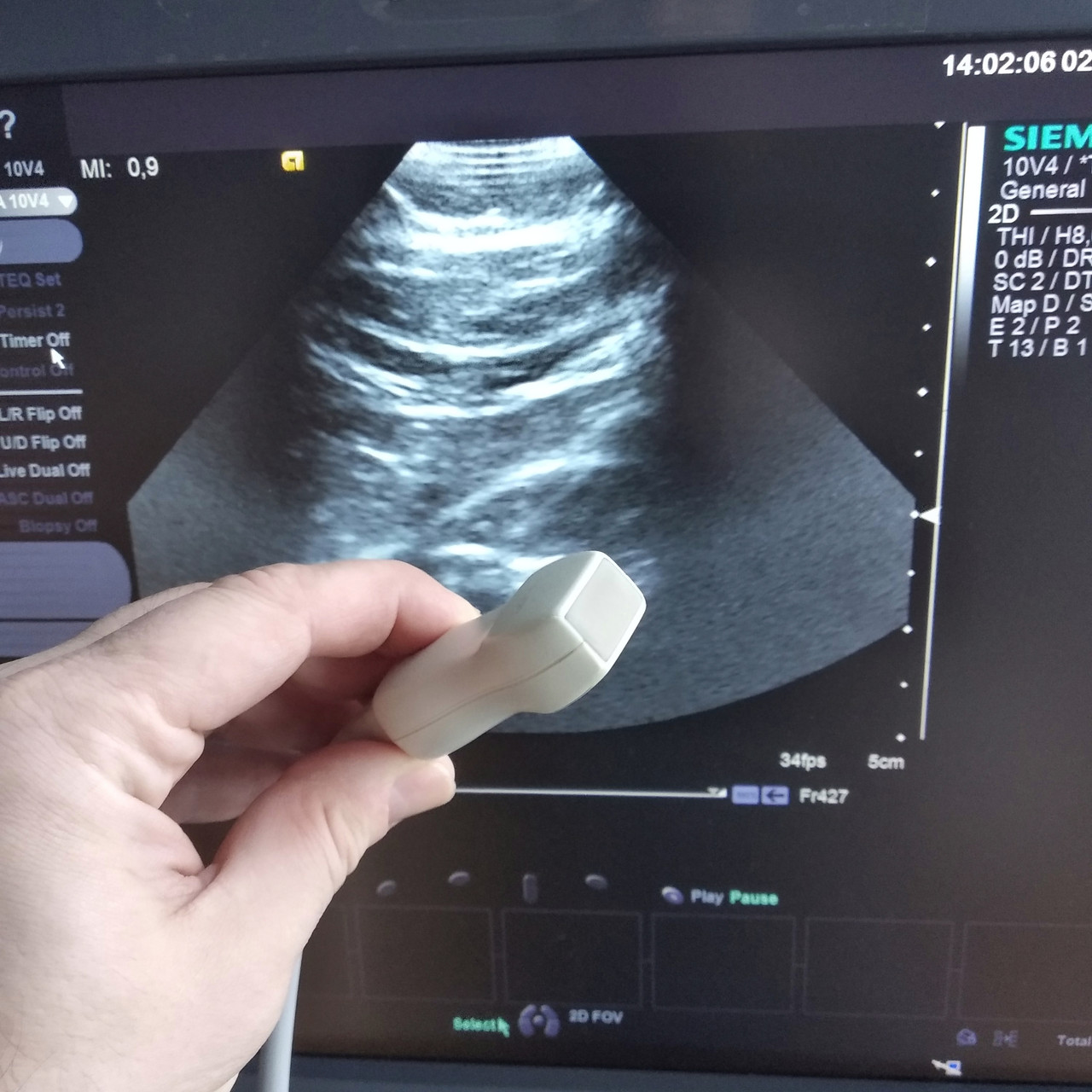 Секторний датчик Siemens Acuson 10V4, фото 1