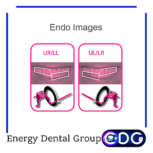 その他 jaxon PROTECH TDL-500 Аксессуары в Киеве от компании 