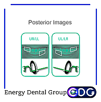 Позиционеры Posterior для датчика радиовизиографа Nanopix