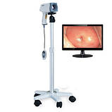 Кольпоскоп Brightfield Healthcare AC-4503, фото 3