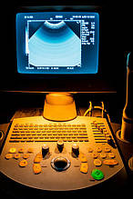 Ультразвуковой аппарат USG Siemens Sonoline Adara Ultrasound