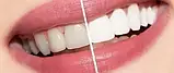 Відбілювач зубів Miracle Teeth Whitener, чорна зубна паста, фото 10