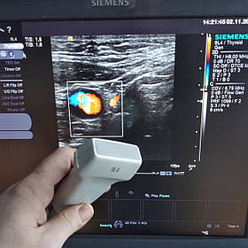 Лінійний датчик Siemens Acuson 9L4