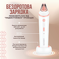 Вакуумний очищувач пор XPREEN 037 Пристрій від чорних точок, алмазний пілінг, вакуумний масаж (XPR-037), фото 8
