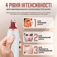 Вакуумний очищувач пор XPREEN 037 Пристрій від чорних точок, алмазний пілінг, вакуумний масаж (XPR-037), фото 4